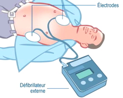 Formation à l’utilisation d’un défibrillateur, le 9 février